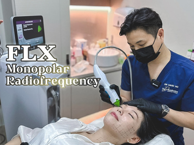 プロフィール｜thermage flx eyes